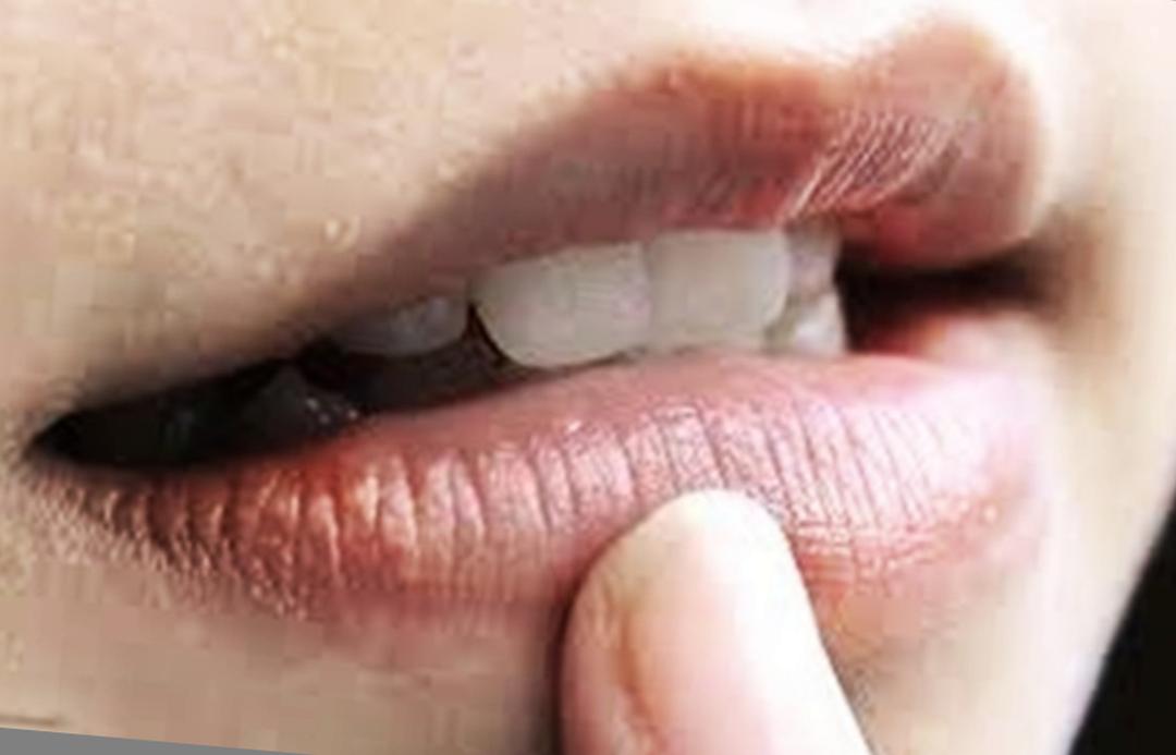 Cara Mengatasi Bibir Kering: Tips Ampuh untuk Menjaga Kesehatan Bibirmu
